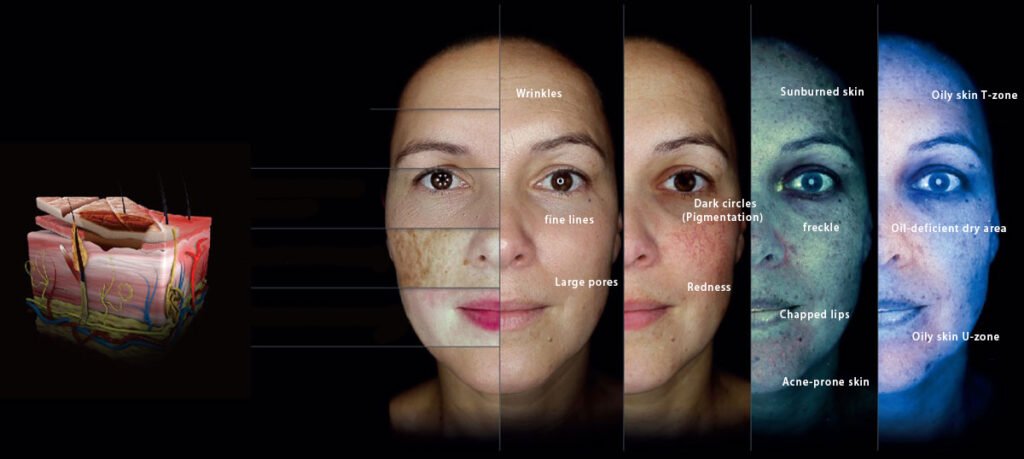 Summary of superficial and deep skin analysis